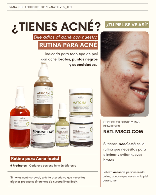Rutina para Acné