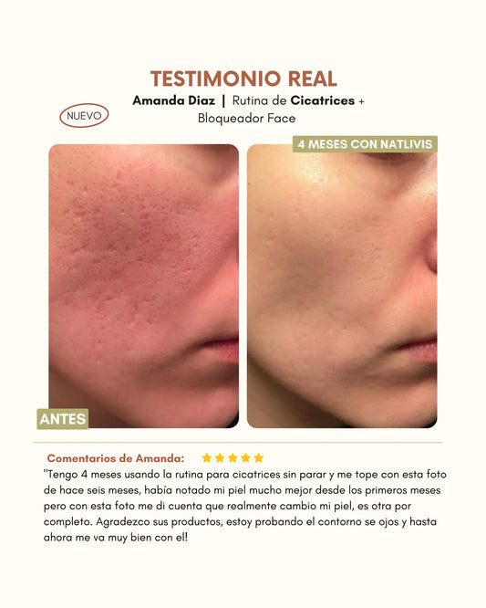 Rutina para Cicatrices